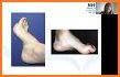 Managing the Diabetic Foot, 3e related image