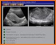 Obstetrics & Gyenacology Ultrasound Guide related image