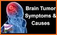 Brain Tumor: Causes, Diagnosis, and Treatment related image