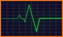 Heart Beat Monitor related image