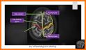 CT Passport Head/Brain / sectional anatomy / MRI related image