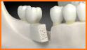 Dental Visual Support related image