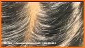 Head Lice related image