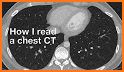 CT Passport Chest / sectional anatomy / MRI related image
