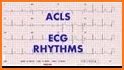 ACLS Rhythms and Quiz related image