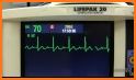 EKG-Monitoring related image