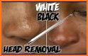 Blemish Remover related image