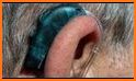 Doctor Ear Aid - Tiny Hearing Aid - Ear Machine related image