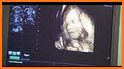 Baby Scan 3D related image