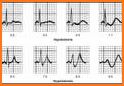Clinical ECG Interpretation related image