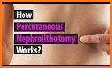 STONE Nephrolithometry - Kidney Stone in Urology related image