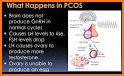 PCOS (Polycystic Ovary Synd.) related image