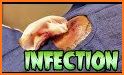 Infection. related image