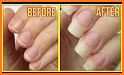 How to Grow Nails Fast related image