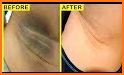 Get Rid Of Dark Knees And Elbows Fast & Naturally related image