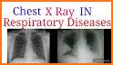 X-Ray Differential Diagnosis related image