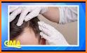 Natural Treatment For Hair related image