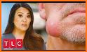 Zit Popper - New Doctor Pimple Pop related image