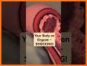 Female Ejaculation Sex ED related image