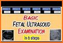 Obstetrics & Gyenacology Ultrasound Guide related image