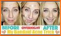 Face Tune Facial Repair Pro related image