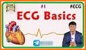 InVivo: ECG Course related image