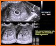 Ultrasound cases + related image