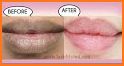 13 Home Remedies To Get Soft Pink Lips Naturally related image