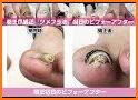 How to grow nails. Correction nails related image