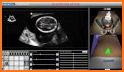 Scanbooster Control sonography related image