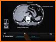Interactive CT and MRI Anatomy related image
