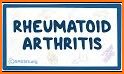 Rheumatoid Arthritis related image