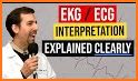 ECG Basics - Learning and interpretation made easy related image