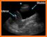 Videos for POCUS: Point-of-Care Ultrasound related image