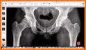 Radiology Xray Medical Imaging related image