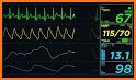 EKG-Monitoring related image