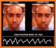 Heart Rate Analyzer related image