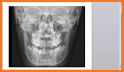 Radiographic Anatomy X-Ray related image