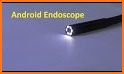 usb camera endoscope related image
