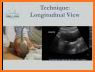 Ultrasound for pregnancy related image