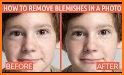 Face Enhancer - Photo Face Blemishes Remover related image