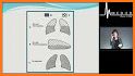 Pulmonary Disease Examination and Board Review related image