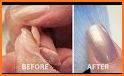 How to grow nails. Correction nails related image