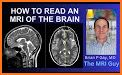 Brain Scan related image