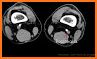 CT Scan Cross Sectional Anatomy related image