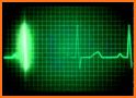 Heartbeat Monitor : Heart Rate, Pulse, Cardiograph related image