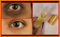 Eye Care - Eye Exercises, Dark Circles, Eyebrows related image