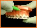 Cleaning Tips with Braces related image