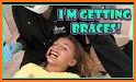 Braces related image