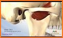 Skull, Teeth & TMJ related image